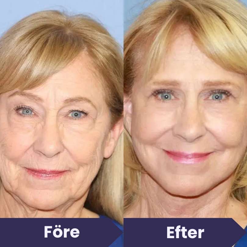 3x BioRenew Serums