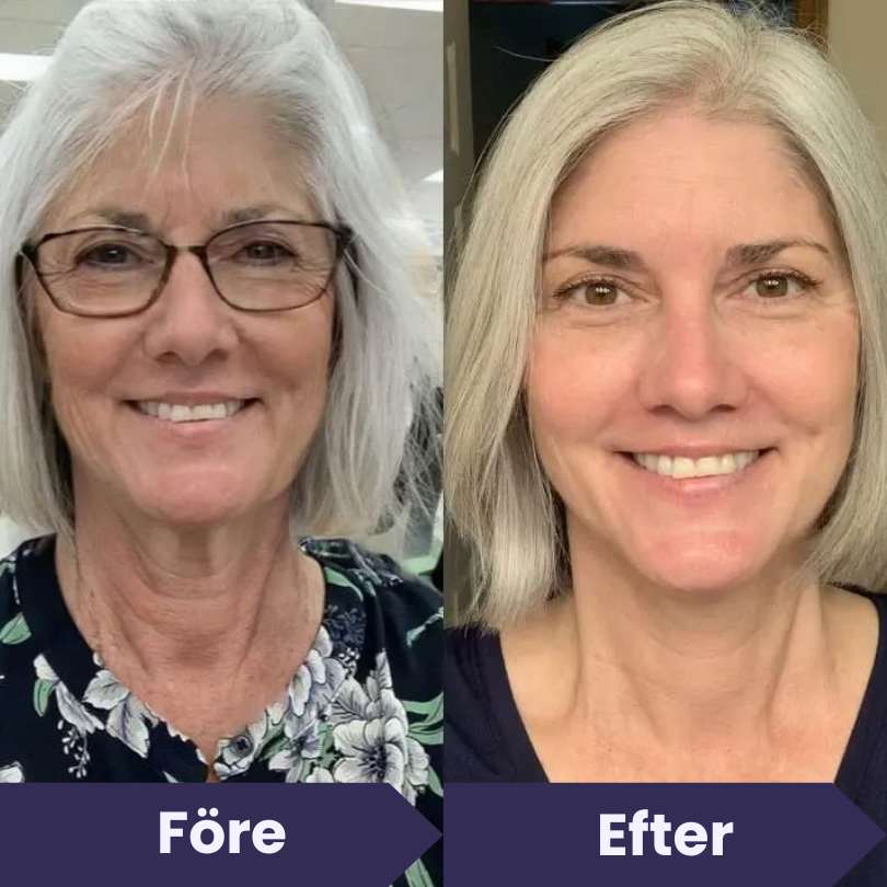 3x BioRenew Serums