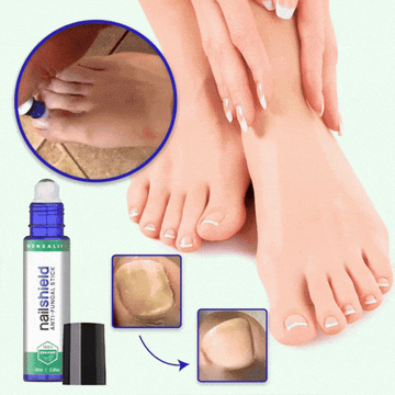 VitaeCharm NailShield Anti-Fungal Stick